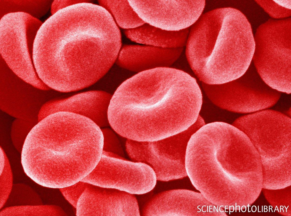 Кровь микро. Эритроциты. Эритроциты красные кровяные клетки. Клетка эритроцита. Красные тельца в крови.