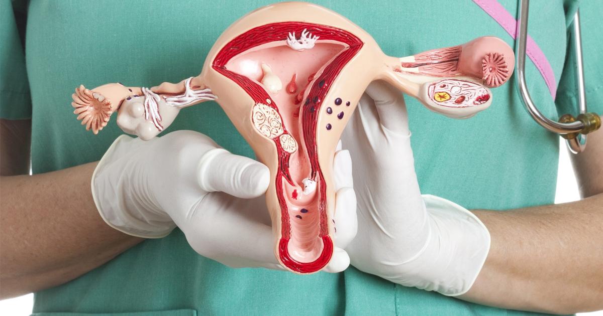 Женщины после удаления яичников отзывы. Операция при субмукозной лейомиоме желудка. Эндоскопическая операция по удалению миомы матки. Фибромиома прогрессирует при.